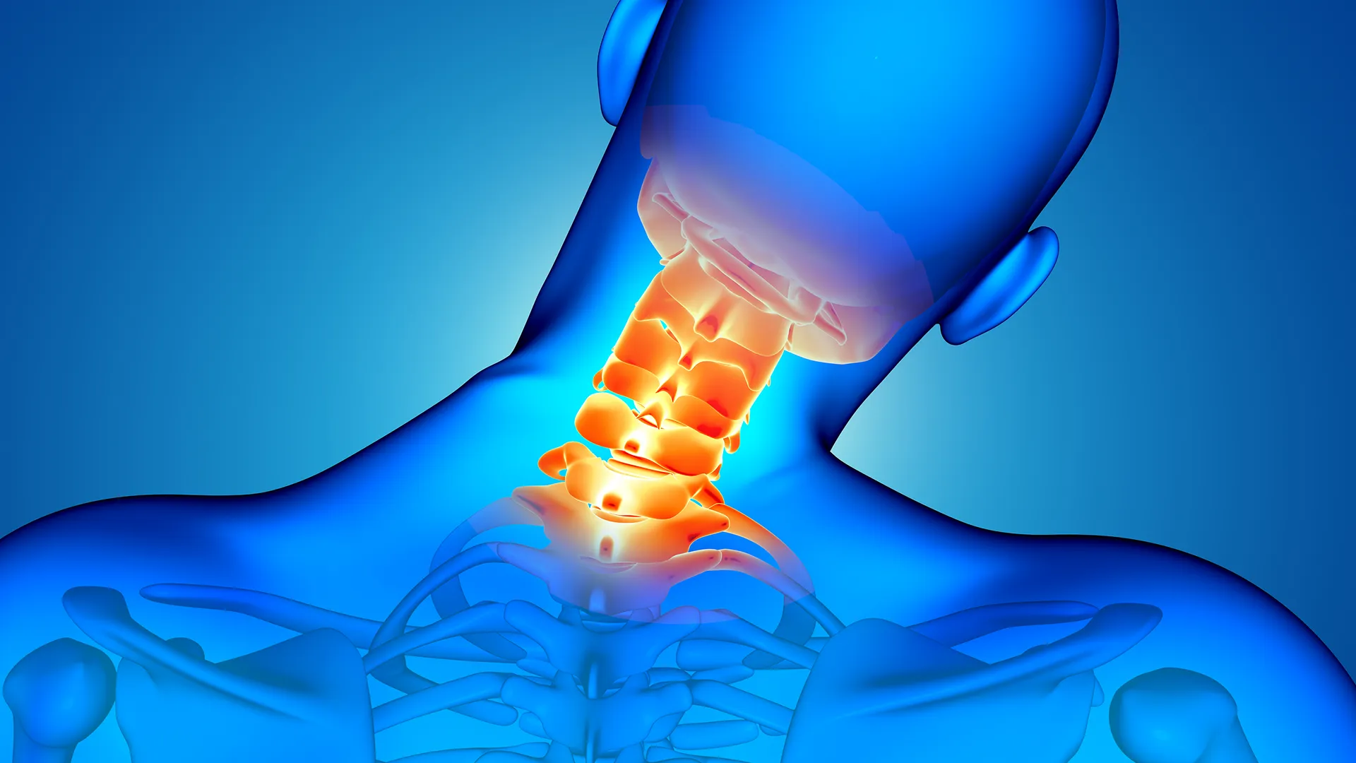 Imagem de raio-x demonstrando problema na coluna cervical
