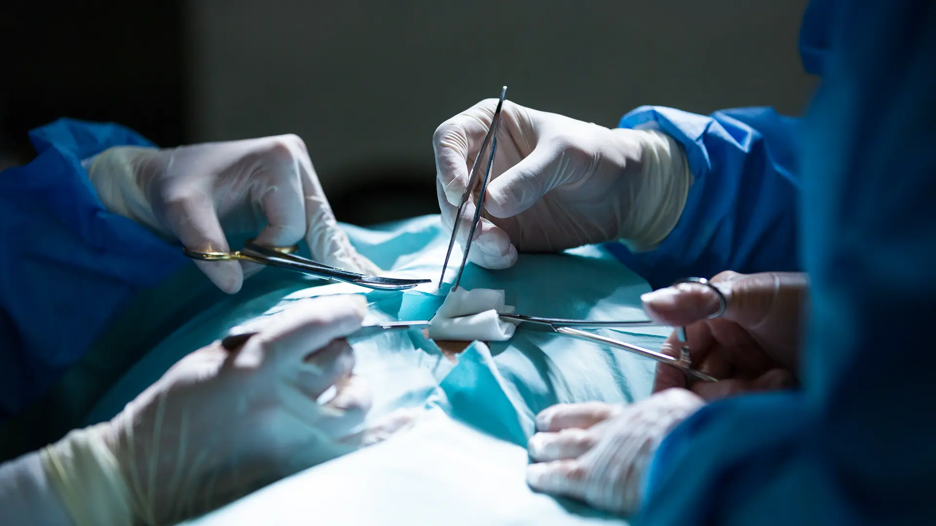 Bisturis reunidos realizando cirurgia