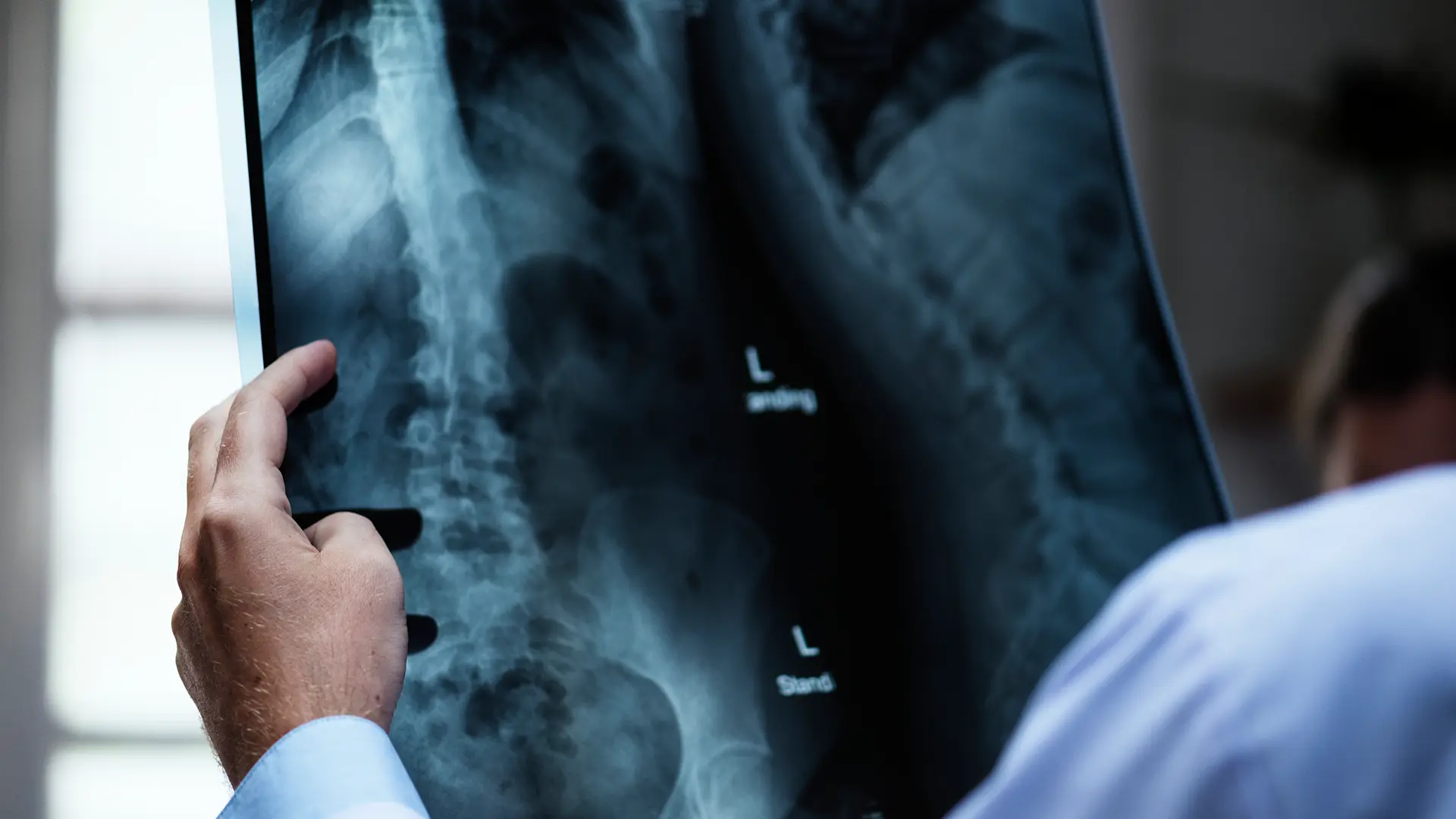 Médico analisando exame de imagem de coluna